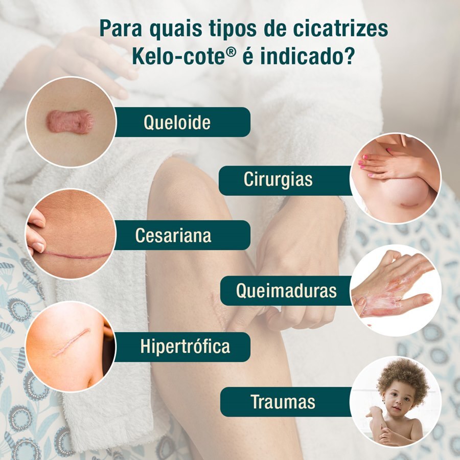 https://cdn.ultrafarma.com.br/static/produtos/774759/large-638913211205009138-774759_7.jpg