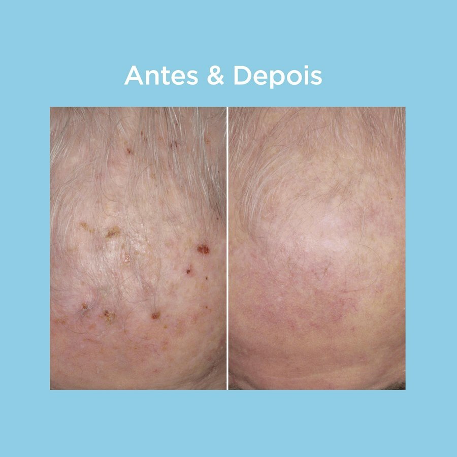 https://cdn.ultrafarma.com.br/static/produtos/803665/large-638912147716198061-803665_6.jpg