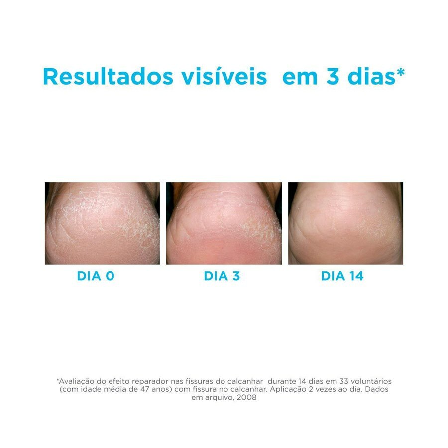 https://cdn.ultrafarma.com.br/static/produtos/804587/large-638912108712682335-804587.jpg