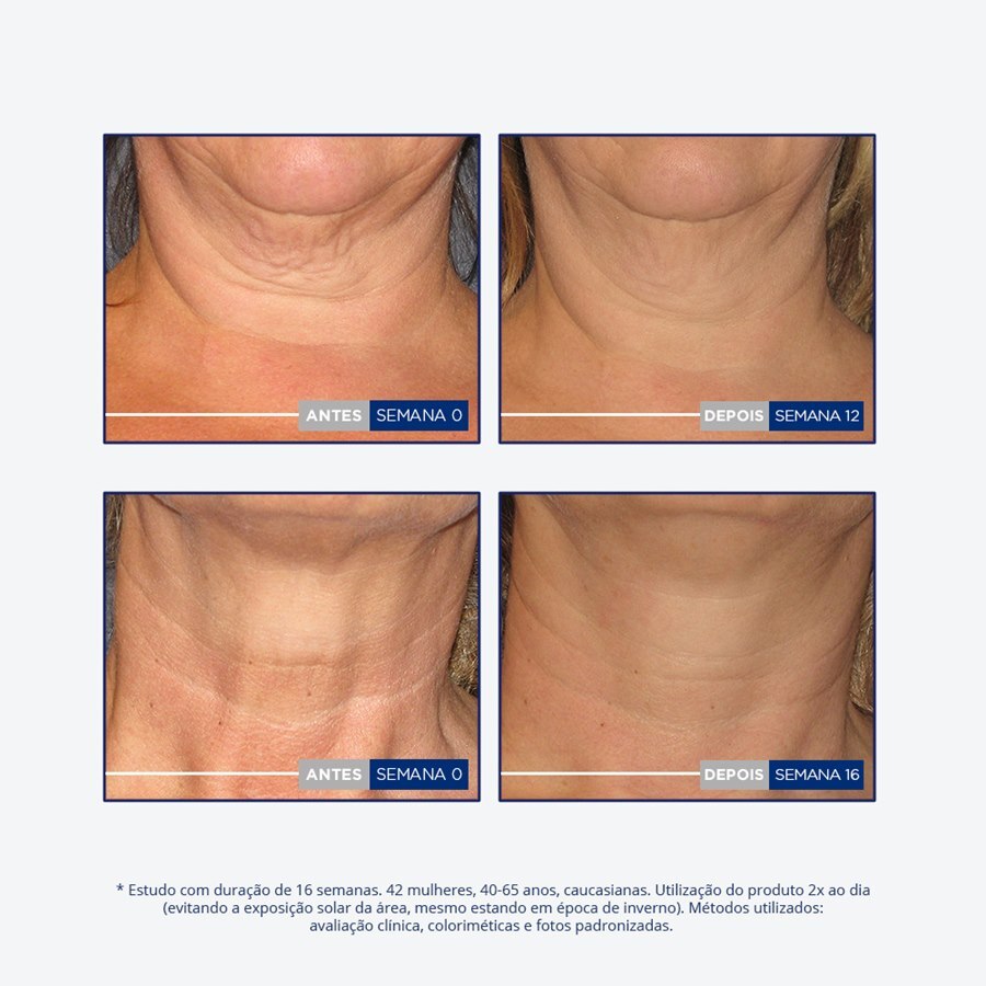 https://cdn.ultrafarma.com.br/static/produtos/809072/large-637241958269553715-809072_7.jpg