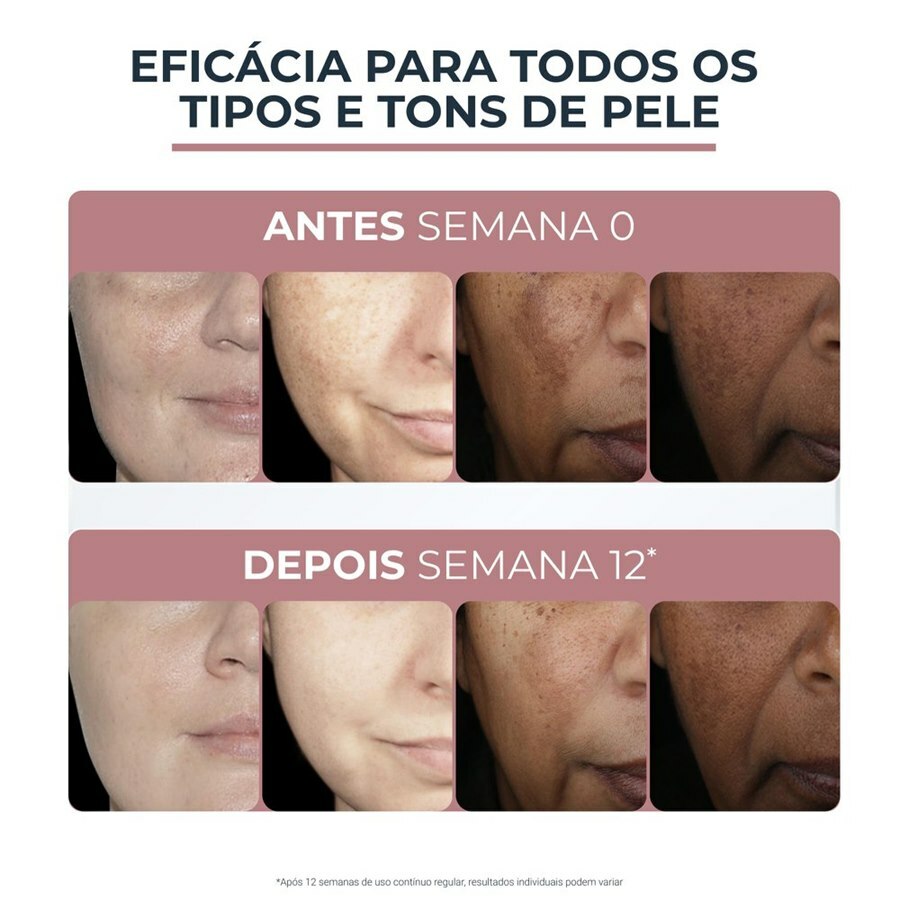 https://cdn.ultrafarma.com.br/static/produtos/814842/large-638822418643007140-814842_7.jpg