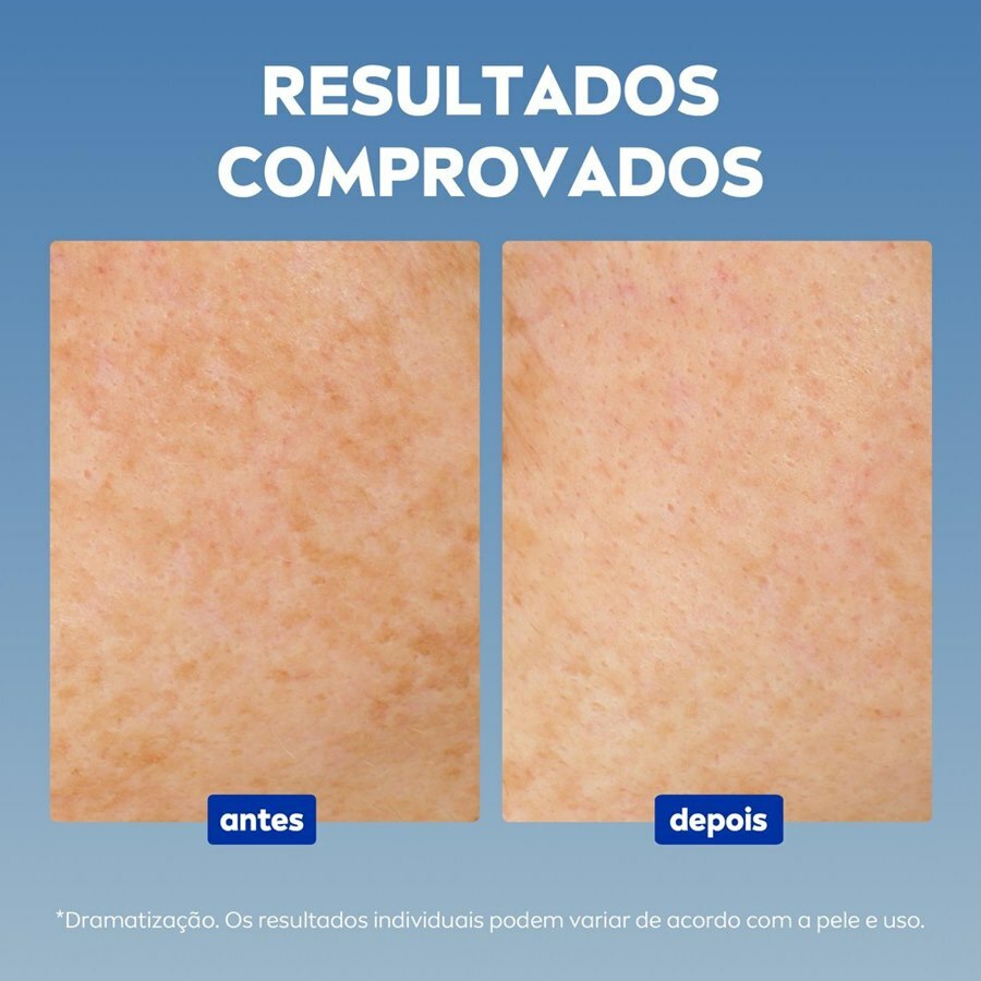 https://cdn.ultrafarma.com.br/static/produtos/818071/large-639053952634904934-818071_5.jpg