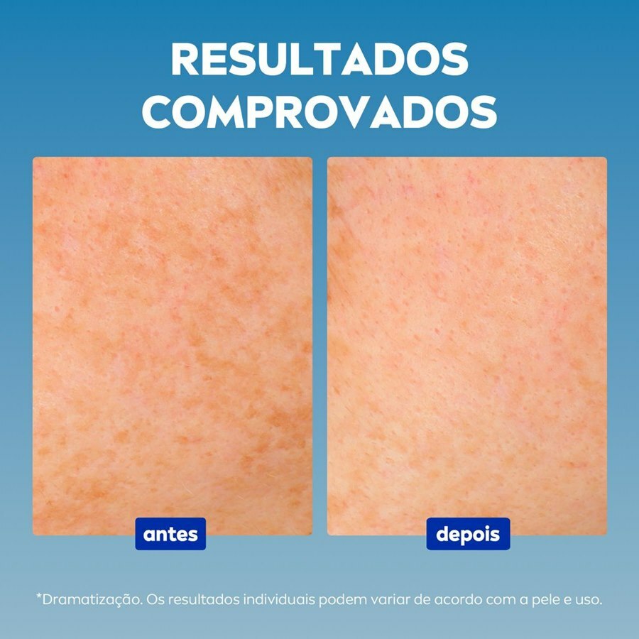 https://cdn.ultrafarma.com.br/static/produtos/818072/large-638822418610036286-818072_5.jpg