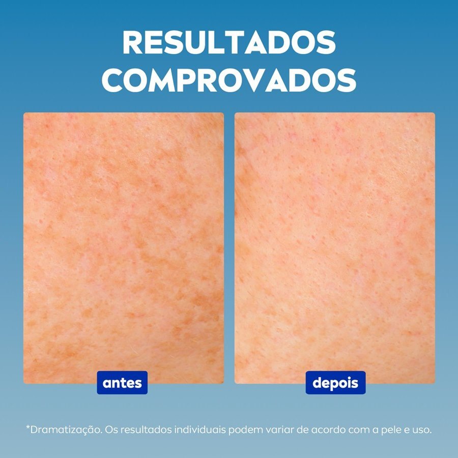 https://cdn.ultrafarma.com.br/static/produtos/818072/large-638828503573930529-818072_5.jpg