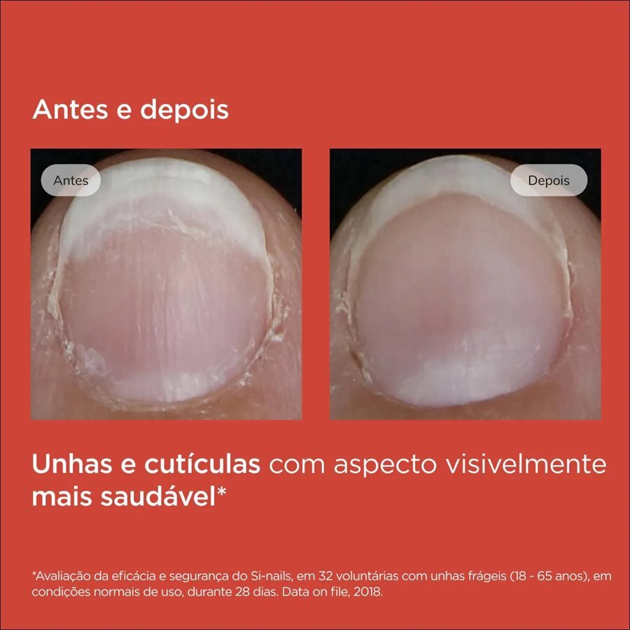 https://cdn.ultrafarma.com.br/static/produtos/818349/large-639184199571069603-818349_5.png