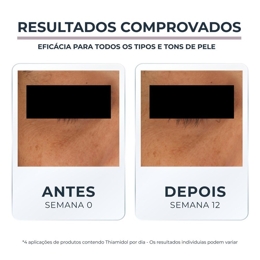 https://cdn.ultrafarma.com.br/static/produtos/827629/large-638828503612646109-827629_5.jpg