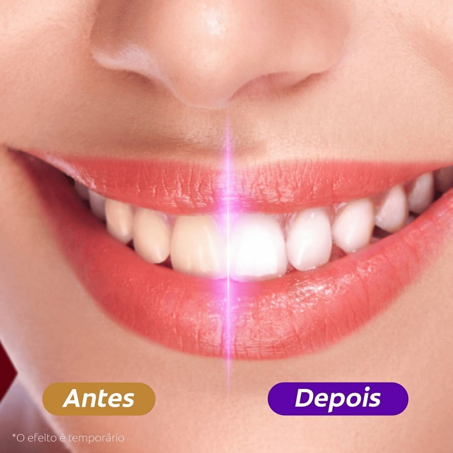 https://cdn.ultrafarma.com.br/static/produtos/834793/large-639283553982047018-834793_6.png